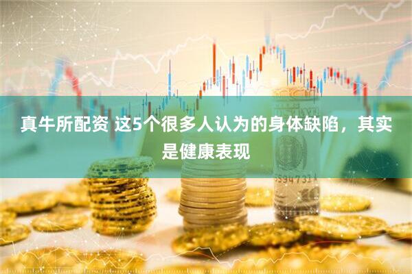 真牛所配资 这5个很多人认为的身体缺陷,其实是健康表现